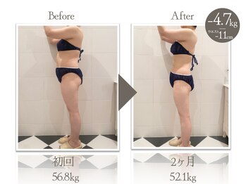 ビューティーリバース 新横浜店/★劇的ビフォーアフター★