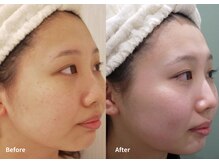 リセラ エン イズモ(recella en izumo)/ビフォーアフター