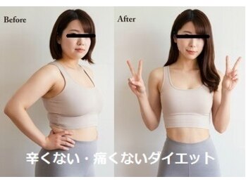 ナチュレアンドメディカ(Nature&Medica)の写真/人生で最後のダイエット！現在最強のオンダは無理なく1回で実感！痩身はもう脂肪冷却、溶解注入の次の時代