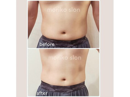 モリコ コンフィデントビューティーサロン(Moriko Confident Beauty Salon)の写真