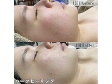 ネイルズビー 別邸(Nail's be)の雰囲気（１回で？トーンアップで激変！触りたくなるうるちゅる肌へ）