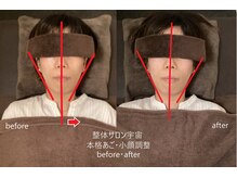 整体サロン宇宙/☆本格あご・小顔矯正☆