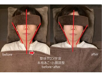 整体サロン宇宙/☆本格あご・小顔矯正☆