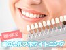 【歯セルフホワイトニング】笑顔に自信がつく白い歯へ☆たっぷり照射¥5900