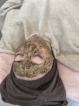 シェリエ(CHERIE)/ハーブピーリング