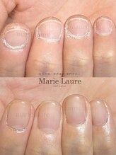 マリーロール 淀屋橋本店(Marie Laure)/自爪育成/深爪矯正/ネイルケア
