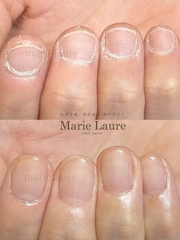 マリーロール 淀屋橋本店(Marie Laure)/自爪育成/深爪矯正/ネイルケア