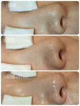 ウィズリーフ(with leaf)/どんどん綺麗に☆