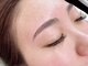 ハイビ(Hibi)の写真/【フェイスWAXで叶える美肌】毛穴・産毛・角質ケアで憧れの赤ちゃんのようなツヤ肌に♪パーツ¥2000～
