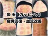 【肩こり腰痛にお悩みの方へ】吸玉筋膜リリース＋リンパマッサージ全身100分