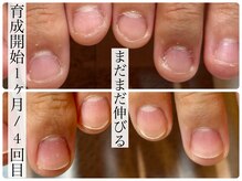 ビビネイル(BIBI Nail)の雰囲気（【本格育爪】深爪や自爪コンプレックスの方は是非ご相談ください）