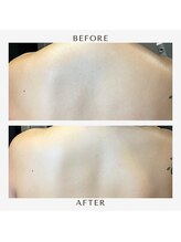 マーク(mark.)/ドレス映え間違えなし♪