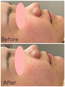 ロイ(Loy)/25/3/14ブログご覧ください♪