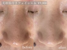 アルム(a'lm)の雰囲気（［フェイシャルエステ］毛穴/シミ/ニキビ/肌質改善/毛穴洗浄）