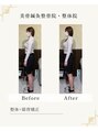 美骨鍼灸整骨院&nbsp;整体×猫背矯正♪巻肩・猫背改善で慢性痛改善◎バストアップも◎
