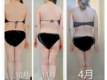 ひぺりかむの雰囲気（4Dayモニター様→「ステップエステ」３月からはステップ2歩き中）