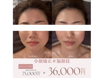 デラッセ(Delasser salon)の写真