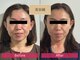 リアライズ(realise)の写真