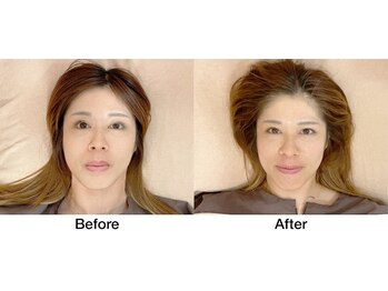 こじま 富雄団地接骨院/Before & After