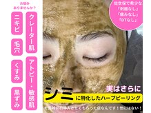 メンテナンス(Maintenance)