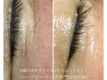 ストーリー 沼津店(STORY)/ハーブピーリング専門店STORY