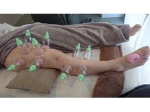 ノームノーム(noam noam)/下肢カッピング前面