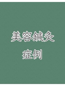 レゴリス/電気美容鍼