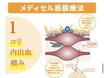 生駒サン整骨院/メディセル整体とは？