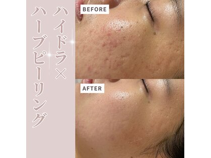 ベル(Belle)の写真