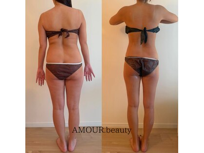 アムール ビューティ(Amour.beauty)の写真