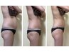 【初回体験】脂肪分解：お腹のぜい肉ケア38500円⇒