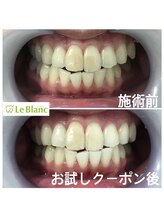 ルブラン 奈良店(Le Blanc)/目に見える着色汚れ