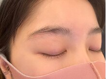 アイマジックピュア 仙台駅前店(EYE MAJIC pure)/Before