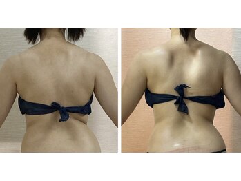 ブランポー(Blanc Peau)/骨盤から整えます