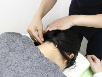 ノモコツ鍼灸 整骨院 イオン盛岡南院(NOMOKOTSU鍼灸 整骨院)/+…施術風景…+　【鍼治療】