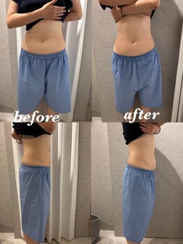 マホロバ セカンド(mahoroba 2nd)/腸マッサージ