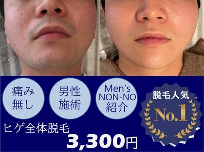 ひかり素肌の写真