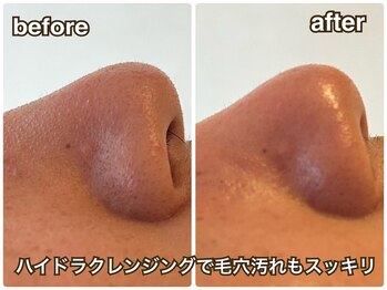 プライベートサロン サイ(sai)/ザラつき肌もツルツルに♪