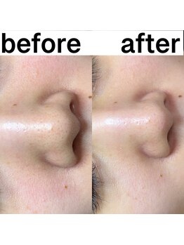 プルティティア 池下 今池 覚王山(Pultitia)/