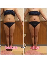 アンリール 旭川店(Anrire)/BODY施術のお客様です！