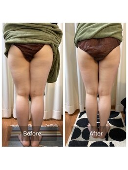 シンシア(sincere)/美脚メニュー