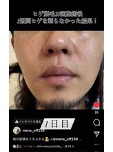 オフ(off)/ヒゲ脱毛