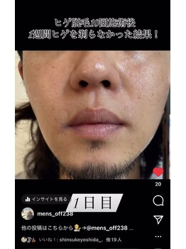オフ(off)/ヒゲ脱毛
