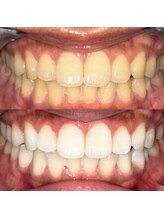 ライトビューティー 池袋店(LightBeauty)/症例写真