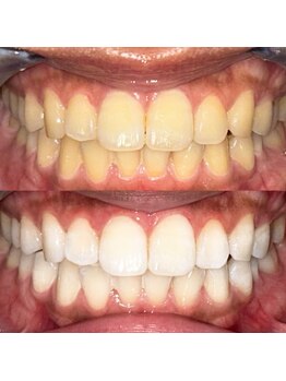 ライトビューティー 池袋店(LightBeauty)/症例写真