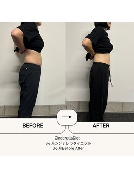 オーシャン整骨院(OCEAN整骨院)/3ヶ月コース