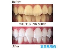 完全個室◎ホワイトニング専門店/ホワイトニング