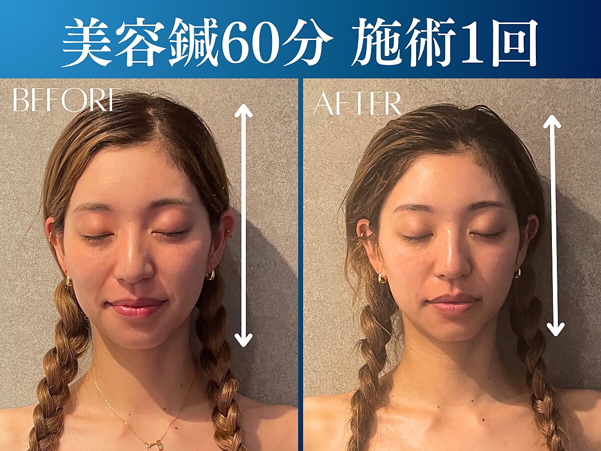 シンク 表参道(CINQ)｜ホットペッパービューティー