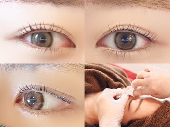 オゾンレメディ(O3remedy)