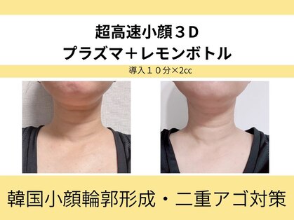 マロン 能町(Marron)の写真